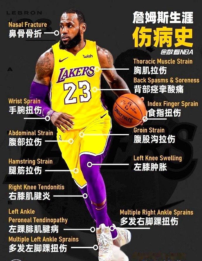 生死战全明星赛前瞻：詹姆斯伤情更新，密尔沃基雄鹿冲击不败纪录(詹姆斯透露个人伤情)